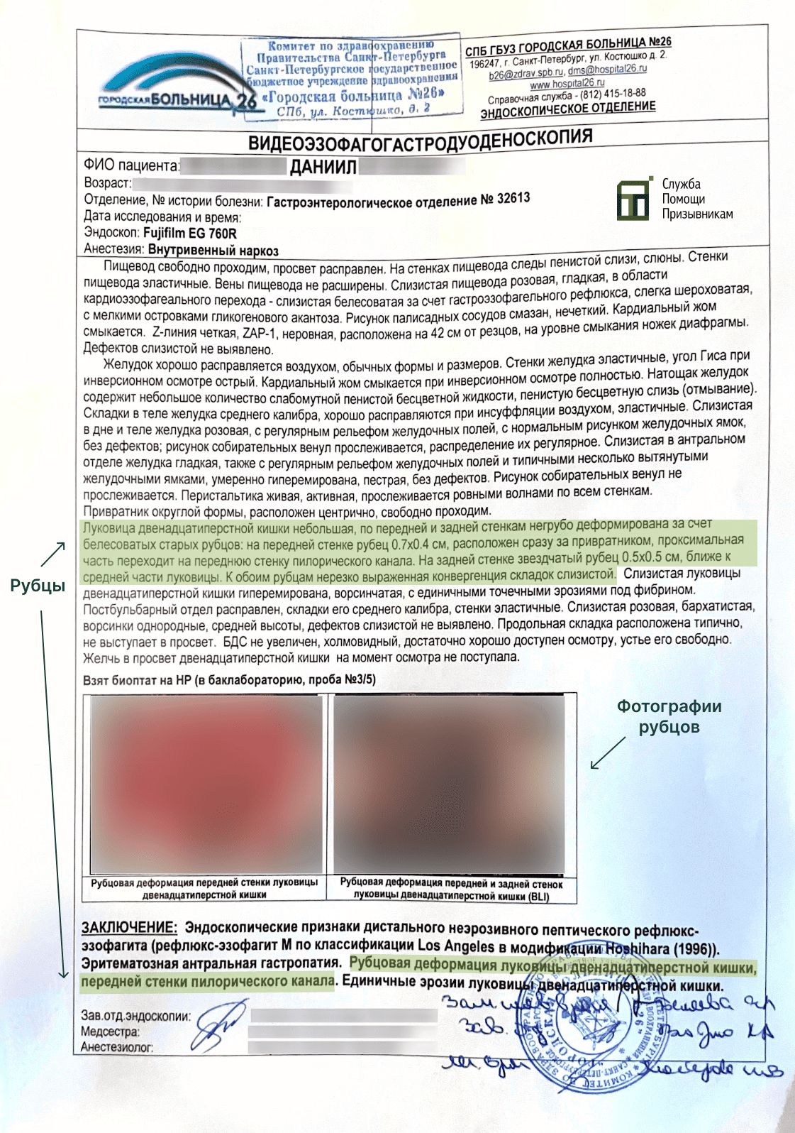 Как доказать язву в военкомате результаты ФГДС для военкомата