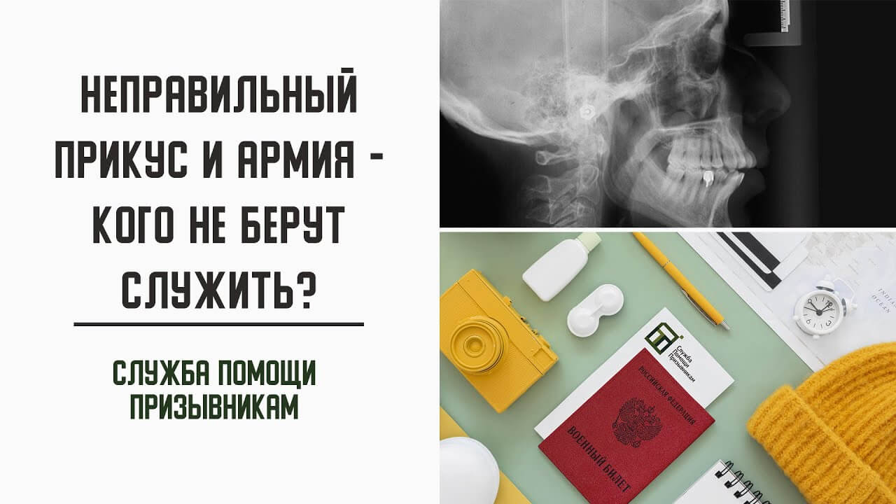 Берут ли в армию с неправильным прикусом