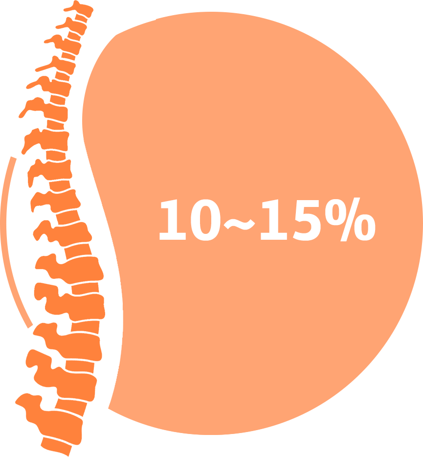 Берут ли в армию с остеохондрозом?