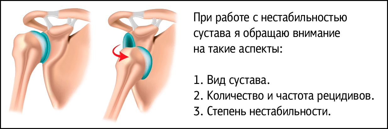 Берут ли после. Нестабильность плечевого сустава. Передняя нестабильность плечевого сустава. Нестабильность коленного сустава. Нижняя нестабильность плечевого сустава.