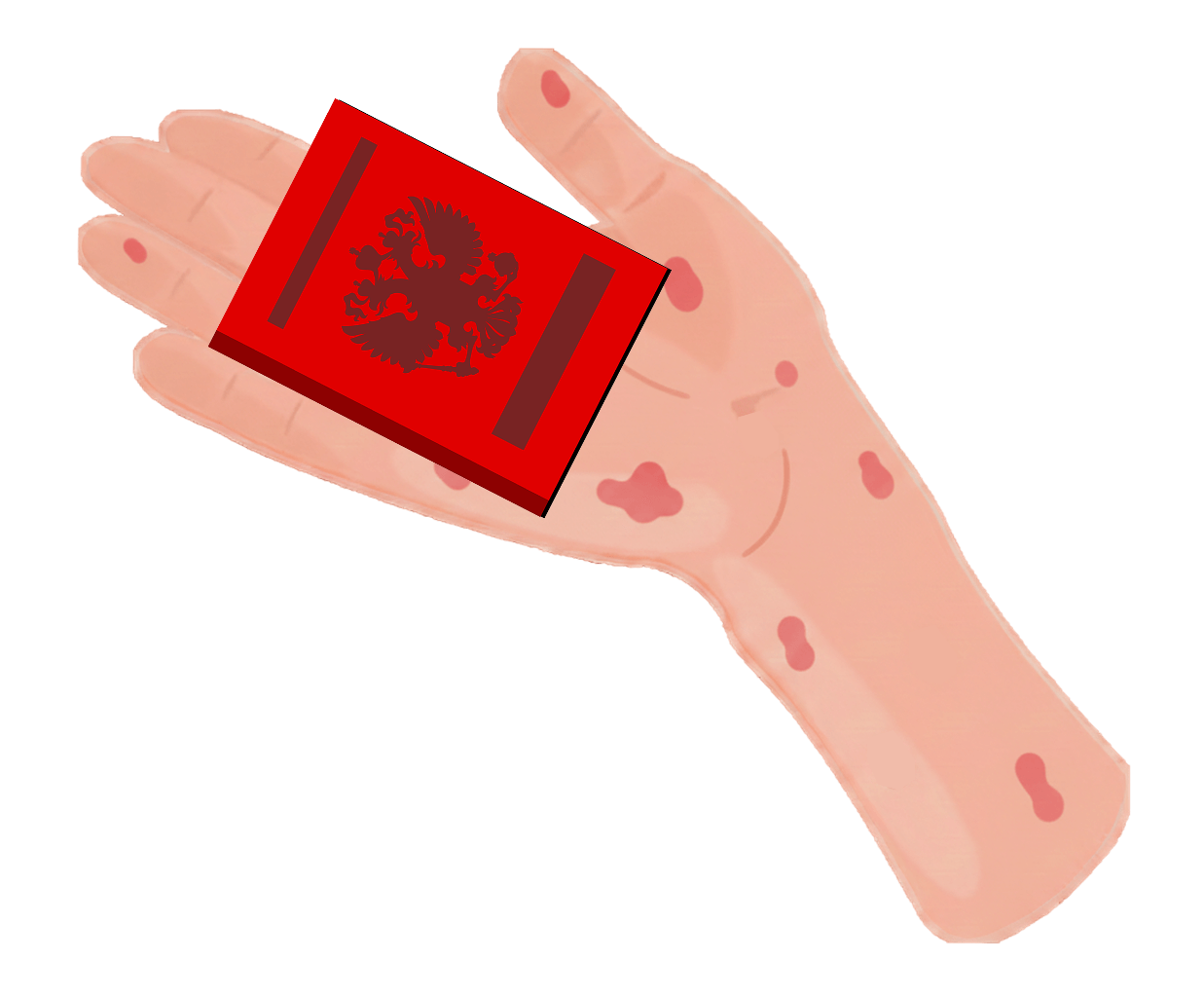 Берут ли в армию с дерматитом