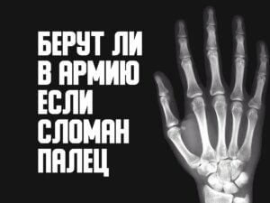 Берут ли в армию со сломанным пальцем