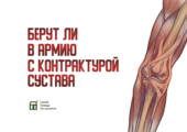 Информация о том, как контрактура влияет на призыв, есть в этой публикации